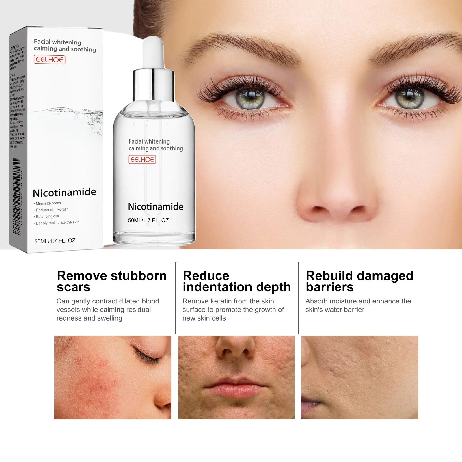 EELHOE nikotinamido serumas
